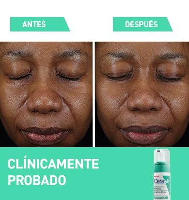 sp-clincally-proven